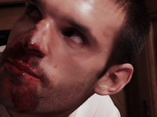 Film d'horreur gore et érotique avec le comédien/acteur Mehdi Boccard - Film Consequence of Lust avec des scènes insoutenables pour les fans de grands frissons - Film pour adultes concentants (interdit aux moins de 18 ans) - Le film Séquelles est très gore et malsain.